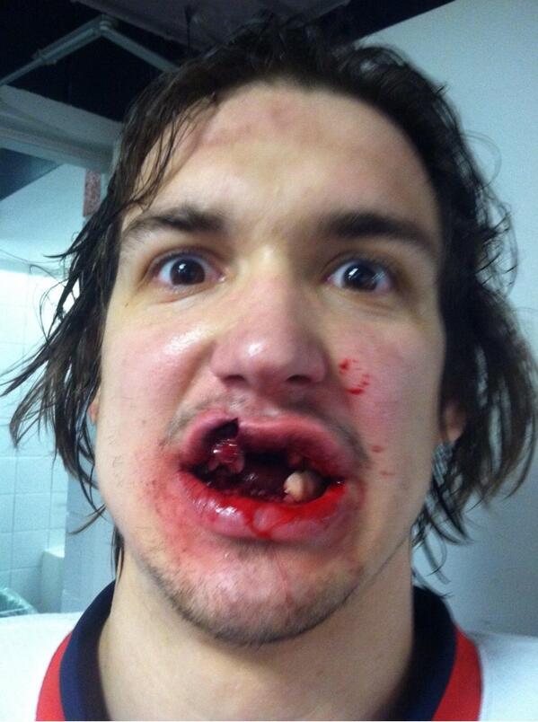 Mitch-Callahan