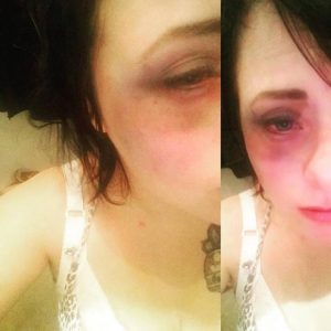 linda-tuukkanen-pahoinpitely