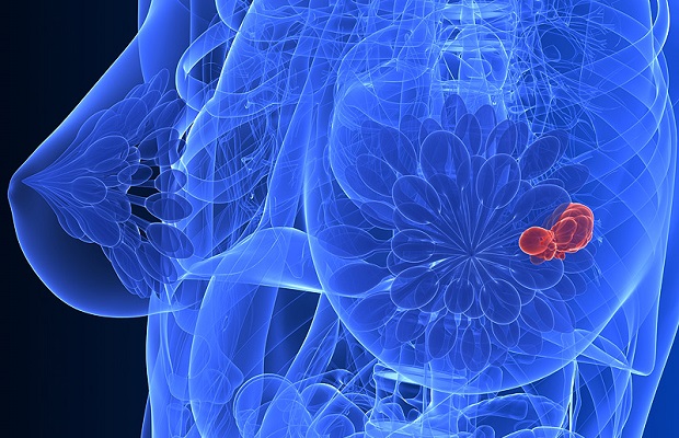 rintasyöpä-solu