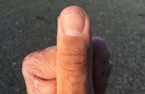 kasi-kynsi-pureskelu-sormi-peukalo-zoom-crop