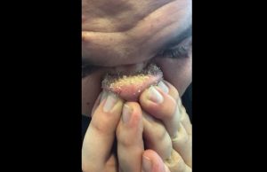 mustapäät-nenä-youtube-jacob-acosta