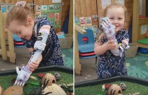 pikkutytto-kasiproteesi-youtube