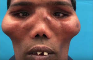 leijonan kasvoinen mies