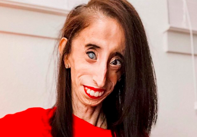 Lizzie Velásquez